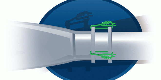 RC Tip - Coupler Connector